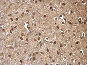 Anti-DDB1 antibody [C3], C-term used in IHC (Paraffin sections) (IHC-P). GTX100232