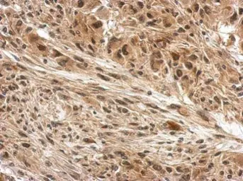 Anti-DDB1 antibody [C3], C-term used in IHC (Paraffin sections) (IHC-P). GTX100232
