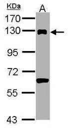 Anti-DDB1 antibody [C3], C-term used in Western Blot (WB). GTX100232