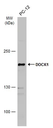 Anti-DOCK1 antibody used in Western Blot (WB). GTX100243