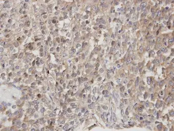 Anti-DOCK1 antibody used in IHC (Paraffin sections) (IHC-P). GTX100243