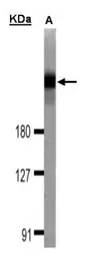Anti-DOCK1 antibody used in Western Blot (WB). GTX100243