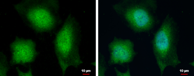 Anti-Calcipressin 1 antibody used in Immunocytochemistry/ Immunofluorescence (ICC/IF). GTX100245
