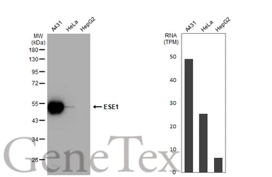 Anti-ESE1 antibody [C2C3], C-term used in Western Blot (WB). GTX100250