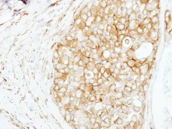 Anti-Cortactin antibody [N1], N-term used in IHC (Paraffin sections) (IHC-P). GTX100253