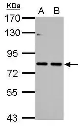 Anti-Cortactin antibody [N1], N-term used in Western Blot (WB). GTX100253