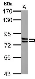 Anti-Cortactin antibody [N1], N-term used in Western Blot (WB). GTX100253