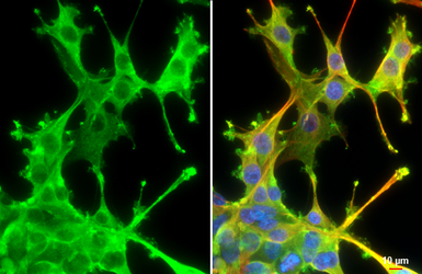 Anti-Cortactin antibody [N1], N-term used in Immunocytochemistry/ Immunofluorescence (ICC/IF). GTX100253