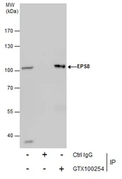 Anti-EPS8 antibody [C3], C-term used in Immunoprecipitation (IP). GTX100254
