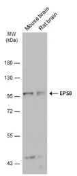 Anti-EPS8 antibody [C3], C-term used in Western Blot (WB). GTX100254