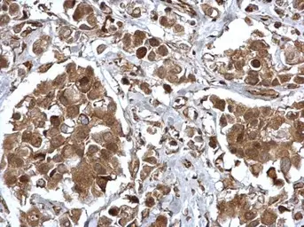 Anti-EPS8 antibody [C3], C-term used in IHC (Paraffin sections) (IHC-P). GTX100254