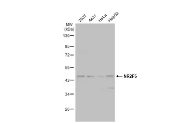Anti-NR2F6 antibody used in Western Blot (WB). GTX100255