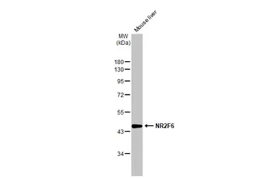 Anti-NR2F6 antibody used in Western Blot (WB). GTX100255