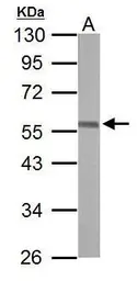 Anti-ERG antibody [C3], C-term used in Western Blot (WB). GTX100257