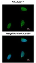 Anti-ERG antibody [C3], C-term used in Immunocytochemistry/ Immunofluorescence (ICC/IF). GTX100257
