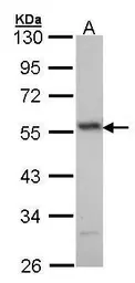 Anti-ERG antibody [C3], C-term used in Western Blot (WB). GTX100257