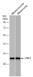 Anti-FHL1 antibody used in Western Blot (WB). GTX100266