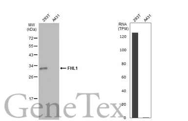 Anti-FHL1 antibody used in Western Blot (WB). GTX100266