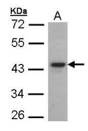 Anti-FOXE1 antibody used in Western Blot (WB). GTX100275