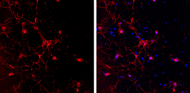 Anti-GAD65 antibody [C2C3], C-term used in Immunocytochemistry/ Immunofluorescence (ICC/IF). GTX100281