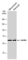 Anti-GAD65 antibody [C2C3], C-term used in Western Blot (WB). GTX100281