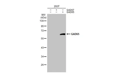 Anti-GAD65 antibody [C2C3], C-term used in Western Blot (WB). GTX100281
