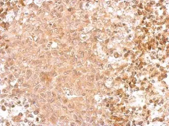 Anti-GAD65 antibody [C2C3], C-term used in IHC (Paraffin sections) (IHC-P). GTX100281