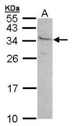 Anti-GEM antibody [N1], N-term used in Western Blot (WB). GTX100287