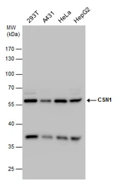 Anti-CSN1 antibody [C3], C-term used in Western Blot (WB). GTX100291