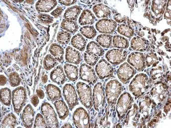 Anti-CSN1 antibody [C3], C-term used in IHC (Paraffin sections) (IHC-P). GTX100291