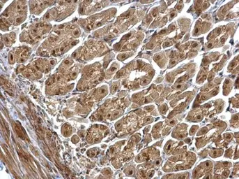 Anti-CSN1 antibody [C3], C-term used in IHC (Paraffin sections) (IHC-P). GTX100291