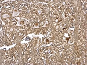 Anti-CSN1 antibody [C3], C-term used in IHC (Paraffin sections) (IHC-P). GTX100291