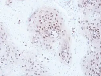 Anti-CSN1 antibody [C3], C-term used in IHC (Paraffin sections) (IHC-P). GTX100291