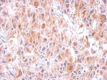 Anti-GSTM1 antibody used in IHC (Paraffin sections) (IHC-P). GTX100298