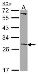 Anti-GSTM1 antibody used in Western Blot (WB). GTX100298
