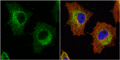 Anti-GSTP1 antibody [N1N2], N-term used in Immunocytochemistry/ Immunofluorescence (ICC/IF). GTX100299