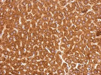 Anti-GSTP1 antibody [N1N2], N-term used in IHC (Paraffin sections) (IHC-P). GTX100299