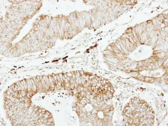 Anti-GSTP1 antibody [N1N2], N-term used in IHC (Paraffin sections) (IHC-P). GTX100299