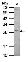 Anti-GSTP1 antibody [N1N2], N-term used in Western Blot (WB). GTX100299