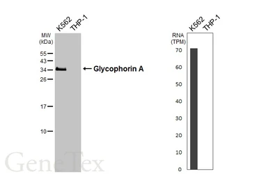 Anti-Glycophorin A antibody [C1C3] used in Western Blot (WB). GTX100300