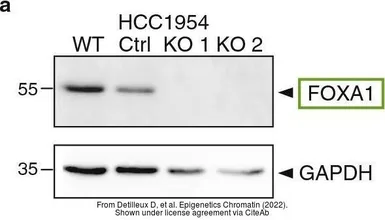 Anti-FOXA1 antibody used in Western Blot (WB). GTX100308