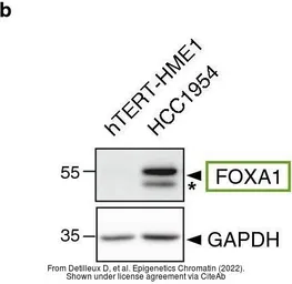 Anti-FOXA1 antibody used in Western Blot (WB). GTX100308