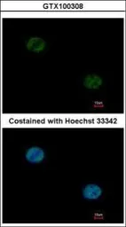 Anti-FOXA1 antibody used in Immunocytochemistry/ Immunofluorescence (ICC/IF). GTX100308