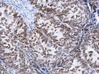 Anti-FOXA1 antibody used in IHC (Paraffin sections) (IHC-P). GTX100308