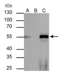 Anti-FOXA1 antibody used in Immunoprecipitation (IP). GTX100308