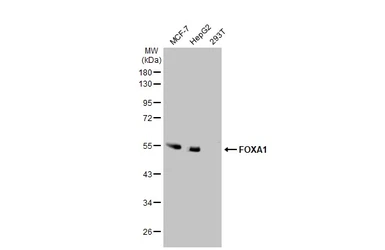 Anti-FOXA1 antibody used in Western Blot (WB). GTX100308