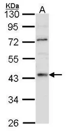 Anti-HNF4 alpha antibody [N1], N-term used in Western Blot (WB). GTX100311