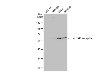 Anti-5-HT2C receptor antibody used in Western Blot (WB). GTX100329