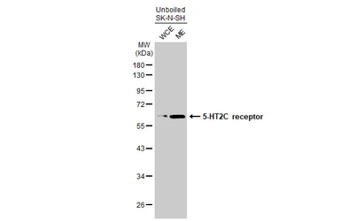 Anti-5-HT2C receptor antibody used in Western Blot (WB). GTX100329
