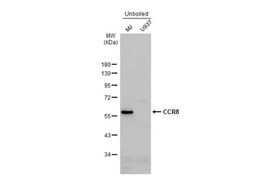 Anti-CCR8 antibody used in Western Blot (WB). GTX100343